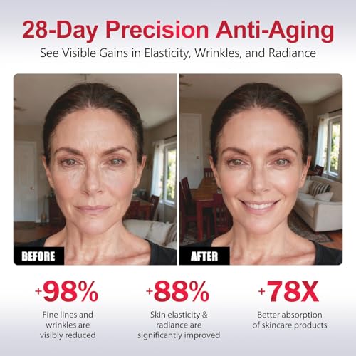 2-in-1 Red Light Microcurrent Facial Device | Enhances Lifting & Firming Capabilities | Reduces Wrinkles and Puffiness | Smart Photon Micro-Current Device, Model:EP-300