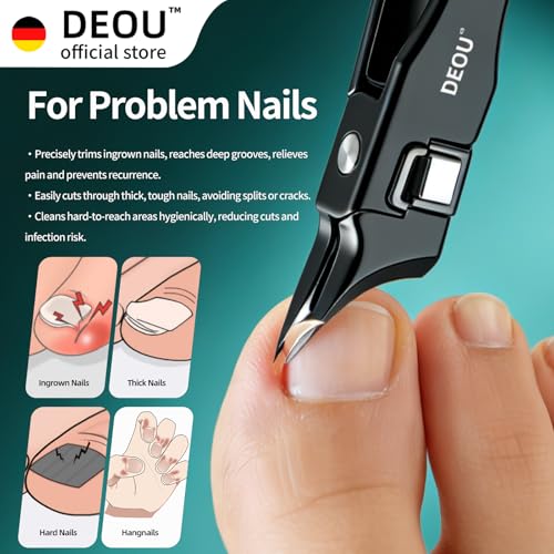 DEOU Ingrown Toenail Clippers with Nail File, Premium Stainless Steel Oblique Cutter, Anti-Splash One-Piece Casting, Manicure Tool with Keyhole, Gift Box for Thick/Hard/Fungal Nails