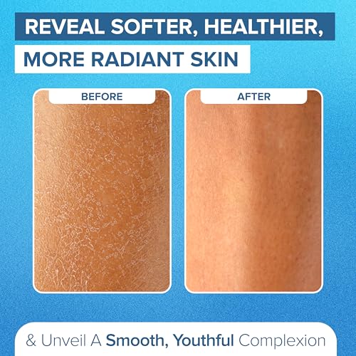 NYK1 Exfoliating Glove for Dead Skin Removal