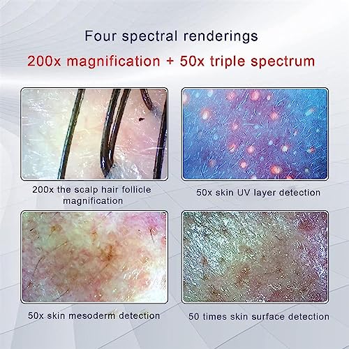 ZIJINGM Skin & Hair Scalp Analyzer 11-Inch HD LCD Microscope with 50X 200X Lenses