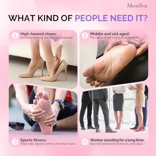 MelodySusie 80PCS Replacement Sandpaper Discs with 25mm Metal Nail Drill Bit, 80 Coarse 150 Medium 240 Extreme Fine Grit for Electric Foot File Callus Remover Tool or Polishing Craft