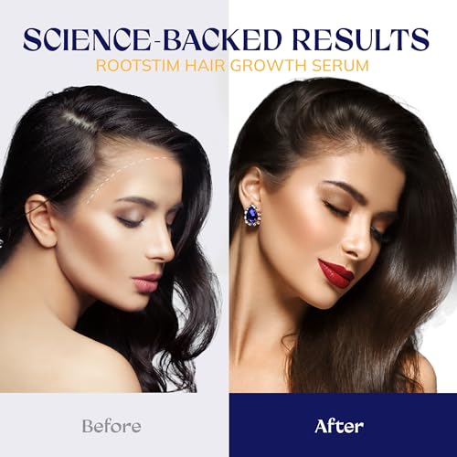 Hair Growth Serum with Biotin & Caffeine for Men & Women