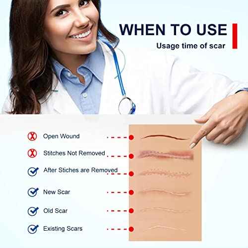 Silicone Scar Sheets Tape for Surgical Scars, C Section Scar Silicone Strips, Medical Grade, Reusable, Soften and Flattens Scars, Breast, Keloid, Professional Scar Patches. (1.8x157 Inch)