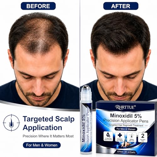 Minoxidil 5% Hair Regrowth Serum Pen - 6 Pack (180mL Total)