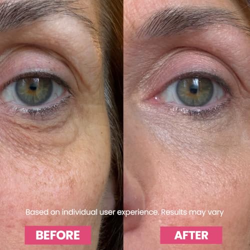 Luxe Korean Under Eye Balm – Lift & Firm 3-in-1