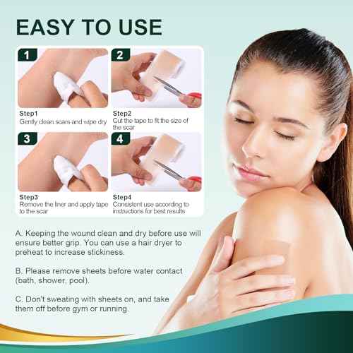 Medical Grade Silicone Scar Sheets, Silicone Scar Tape (1.6¡±x 60¡± Roll-1.5M), Professional Scar Removal Treatment, Reusable Silicone Scar Strip for Keloid, C-Section, Surgery, Burns, Acne Etc