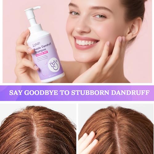 Dandruff Shampoo And Conditioner Set for Women & Men,Deep Cleanser - Purple Dandruff and Dry Itchy Scalp - Therapeutic Grade - Helps Promote Hair Growth - 16.9 Fl Oz