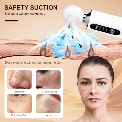 Rechargeable Blackhead Suction Device with LED Light & 5 Tips