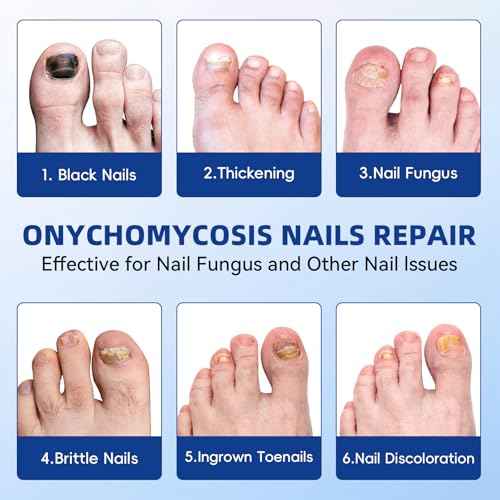 Nail Patches Toenail Treatment Extra Strength, 8-Hour Overnight Nail Fast Acting Repair Effortless Hydrogel Nail Care and Repair for Damaged Nails Overnight Renewal 21 Patches