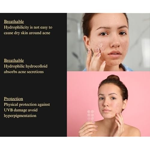 Pimple Patches ? Hydrocolloid with Salicylic Acid, Tea Tree Oil & Niacinamide ? Invisible, Waterproof for Blemish-Prone Skin ? 36 Count