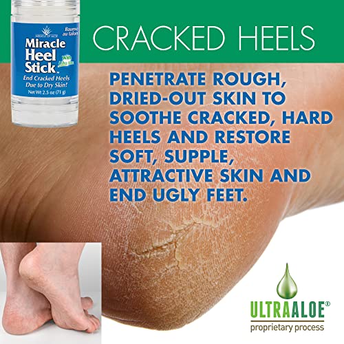 Miracle Heel Balm & Foot Repair Cream – Aloe Moisturizer for Cracked Feet