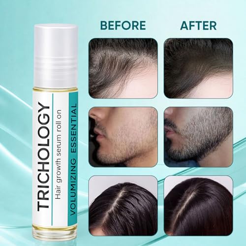 Hair Growth Serum Roll-On with Rosemary & Ginger (2 Pack)