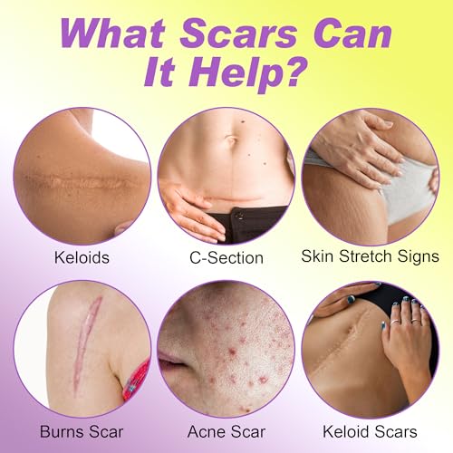 FRESINIDER Silicone Scar Sheets Roll - 1.6" X 120" (3 Meters) Silicone Scar Tape for Surgical C-Section Tummy Tuck, Keloid Burn Acne - Extra Long & Reusable Professional Scar Removal Strips