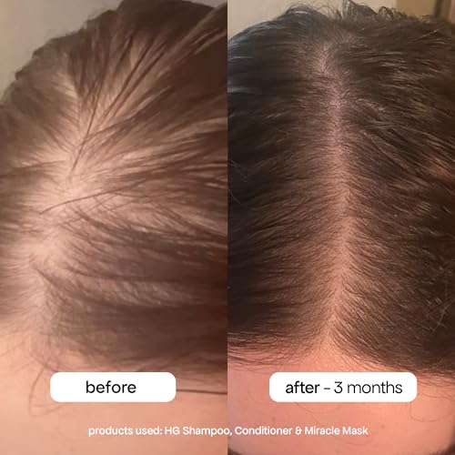 BONDIBOOST HG Anti-Thinning Shampoo 10.14 fl oz for Thinning Hair, Men & Women