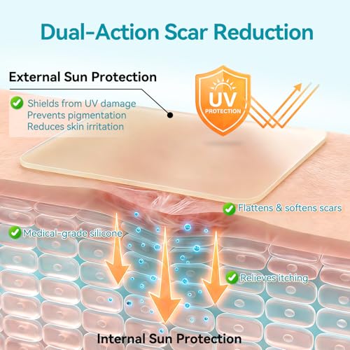 Dimora UPF50+ Silicone Scar Sheets with UV Protection Reusable Sheets to Soften, Flatten Fade Scars, Reduce Redness for Surgical, C-Section, Burn, Keloid, and Hypertrophic Scars (1.6¡±x78.7 Roll)