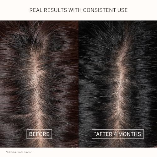 ACTIIV Densifying Hair Serum - Water-Based Thickening Serum, 1.8 fl oz
