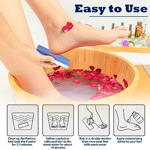 Double-Sided Foot Pumice Stone 6-Pack - Callus Remover & Foot Exfoliator