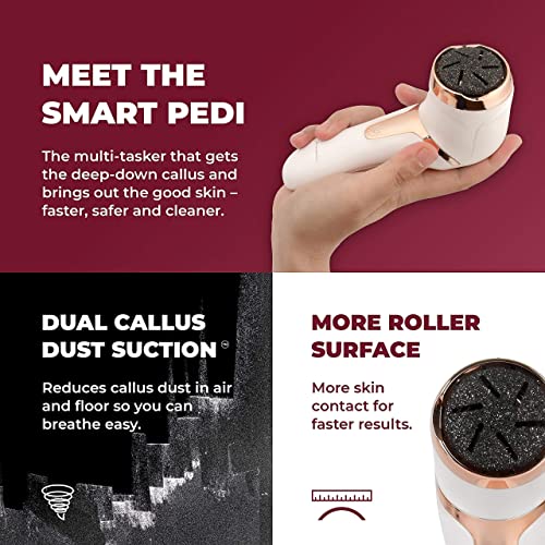 Own Harmony Electric Callus Remover with Vacuum and 7 Rollers Bundle - Foot Care for Women - Professional Pedicure Tools for Pedi Care Vac, CR2100 Electric Feet File, Best for Hard Dry, Cracked Heels