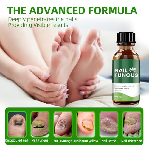 NoxyRal Extra Strength Toenail Fungus Treatment Brush-On with Botanical Oils, 1 fl oz