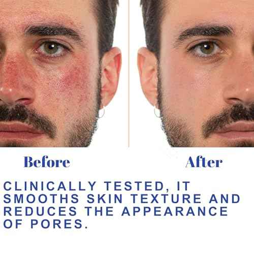 Hydrating Toner for Face, Refreshing Face Mist | Rose Water Toner with Witch Hazel Salicylic, & Glycolic Acid | A Zero Pore Cleanser, Helps Fade Dark Spots & Minimize Pores, Alcohol-Free, 100 ml