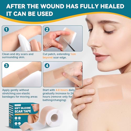Silicone Scar Tape for Surgical Marks Face Stick Keloid Cover C-Section Strips Wrinkle Cream Lip Sleeping Gel Sheet Tummy Patch Hydrocolloid Roll Soft (3 Pack, 1.6"X 60")