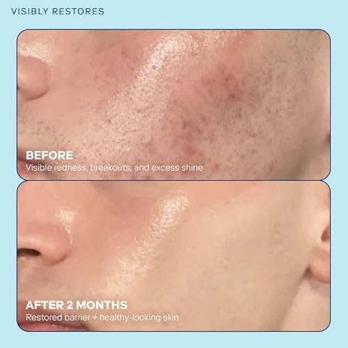 Skinfix Barrier+ Skin Barrier Restoring Gel Cream Mini - 0.5 oz - Hydrating Face Cream for Dry Skin - Strengthens, Visibly Plumps & Firms - Non-Comedogenic - Fragrance Free - Vegan, Cruelty Free