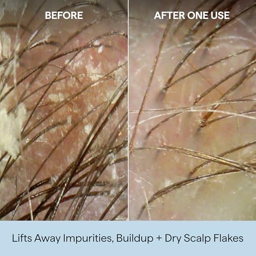 Briogeo Scalp Revival Charcoal + Coconut Oil Micro-Exfoliating Shampoo