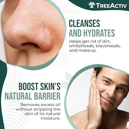 TreeActiv Charcoal Acne Exfoliating Face Wash | Hydrating Sulfur Cleanser for Pimple, Zit, Whitehead, & Blackhead | Facial Treatment for Hormonal & Cystic Acne | Teen & Adult Milia Remover | 425+ Uses