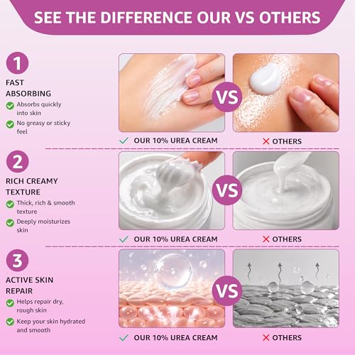 10% Urea Cream with Aloe Vera & Jojoba Oil - 150ml