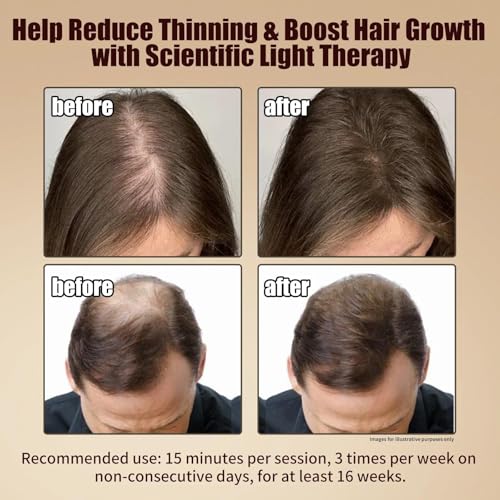 Laser Therapy Hair Growth Comb - Red Light LLLT Device