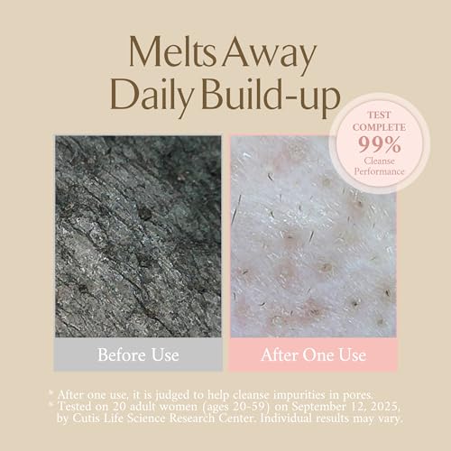 LA MUSE Melting Cleansing Balm – Hydrating Makeup Remover & Pore Cleanser, 6.76 fl oz