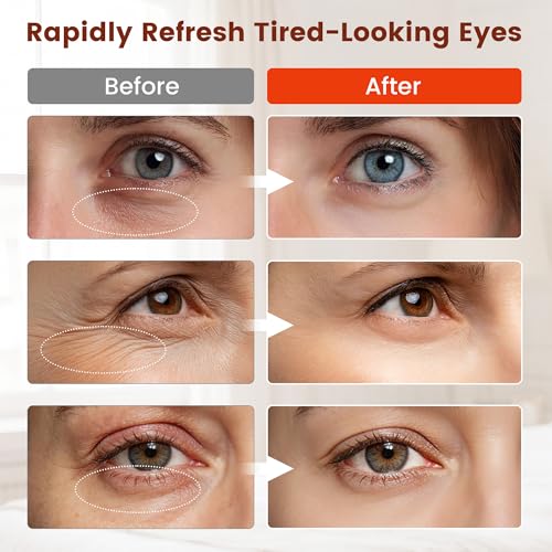 Viconor Red Light Therapy for Eyes - Under Eye Brightening & Puffiness Relief