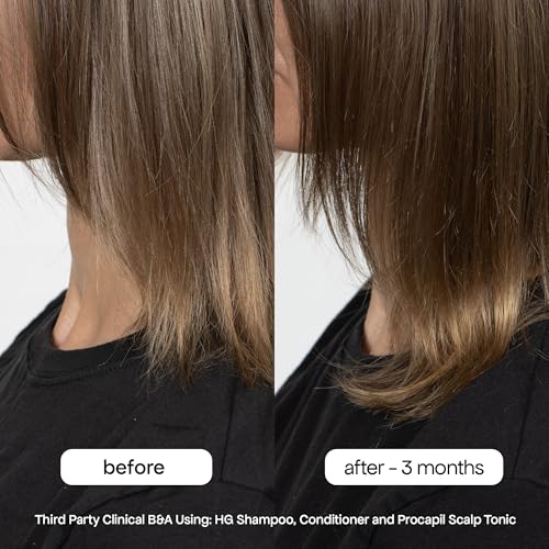 BONDIBOOST HG Anti-Thinning Shampoo 10.14 fl oz for Thinning Hair, Men & Women