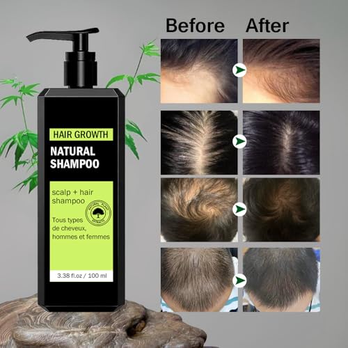 Natural Hair Growth Shampoo for Thinning Hair - 2 Pack