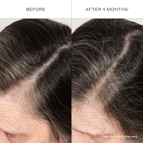 Zenagen Densifying Hair Serum for Thicker Fuller Hair