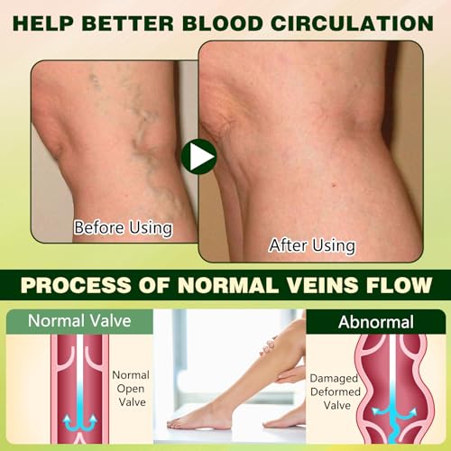 LHBMET Professional Leg Circulation Cream - Edema Relief & Skin Soothing, 1PC