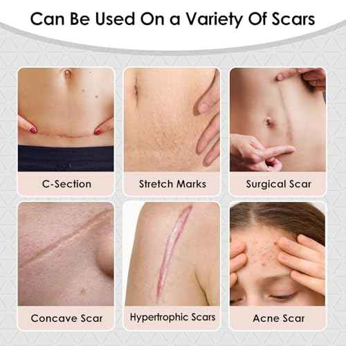 Silicone Scar Sheets,Silicone Scar Tape for Removal Treatment,Medical Grade Scar Tape for Surgical Scars,C-Section,Tummy Tuck,Scar Removal Away(1.6" x 60" Roll - 1.5M) Keloid Bump Removal