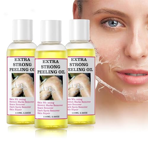 Yellow Peeling Oil - 330ML/10.98Fl Oz, Chemical Peel for Dark Skin, Exfoliating Body Oil for All Skin Types