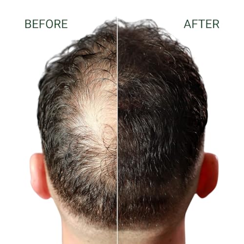FIBR Hair Keratin Building Fibers for Thinning Hair - Dark Brown