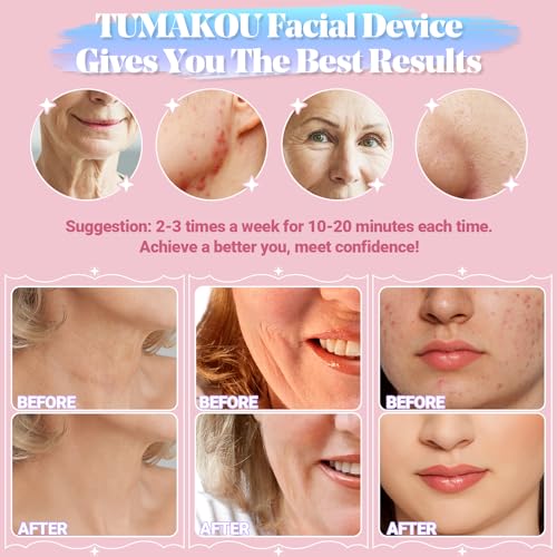 High Frequency Facial Machine - TUMAKOU Portable Handheld High Frequency Wand with 6 Pcs Violet Tubes for Face Home Use Device