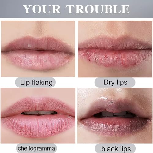 Turmeric Lip Scrub & Balm for Dark Lips, 2 Pack