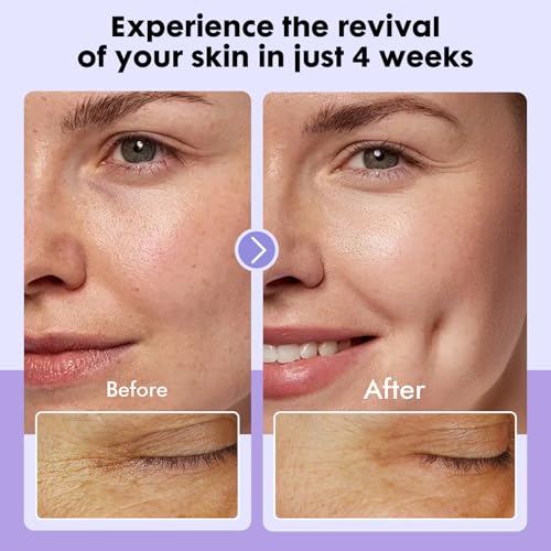 Dermasof Multi Peptide Power Serum for Face with Copper Peptides, Anti Aging, Firming and Lifting, Reduce Fine Lines and Wrinkles, Boost Collagen, Hydration, Barrier Repair, For All Skin Types 30mL