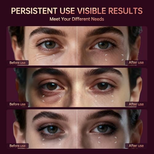 Red Light Therapy for Eyes, 4-in-1 3 Minutes Treatment Under Eye Red Light Mask, Targets Fine Lines, Eye Bags, Wrinkles & Dark Circles, Rejuvenating Eye Massager for Men Women (Pink)