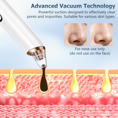 HZD Blackhead Remover Pore Vacuum with 3 Suction Levels & 6 Tips