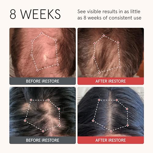 iRESTORE Biotin Hair Conditioner for Fine & Damaged Hair