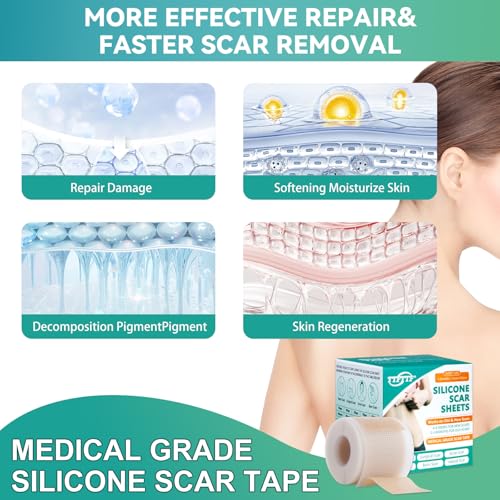 Silicone Scar Tape, Silicone Scar Sheets(1.6"X 160" Roll-4M), Reusable Medical Grade Silicone Tape for Scars, C-Section, Keloid, Acne, Tummy Tuck, Surgical Scars, Light