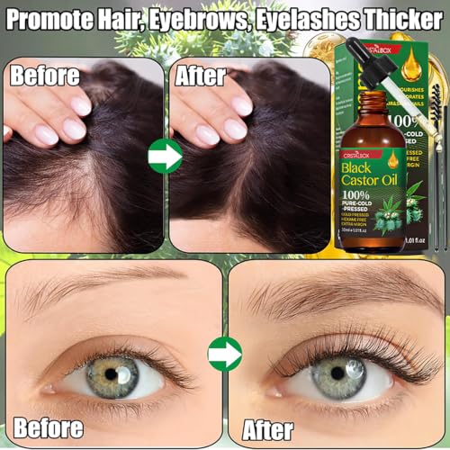 CRISTALBOX Organic Jamaican Black Castor Oil – 3 Pack 100% Pure for Hair, Skin & Nails