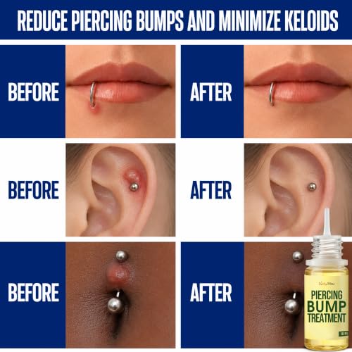 3-in-1 Piercing Aftercare Kit with Saline Spray & Bump Treatment