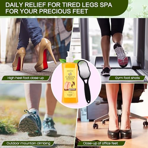 Foot Callus Remover Gel Kit with Foot Files for Smooth Feet