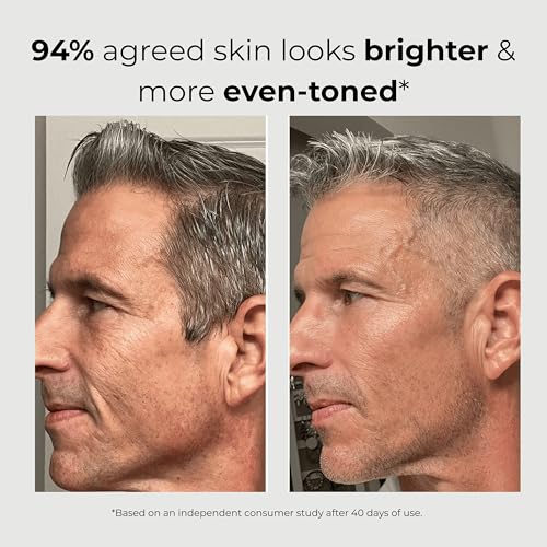 ABERA Men 6-in-1 Retinol Serum for Face, Melasma Treatment with Niacinamide & Hyaluronic Acid, Reduces Fine Lines, Wrinkles, Dark Spot Remover, Evens Tone with Aloe & Centella Asiatic (Pack of 2)